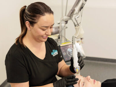 Radiofrequency Skin Needling